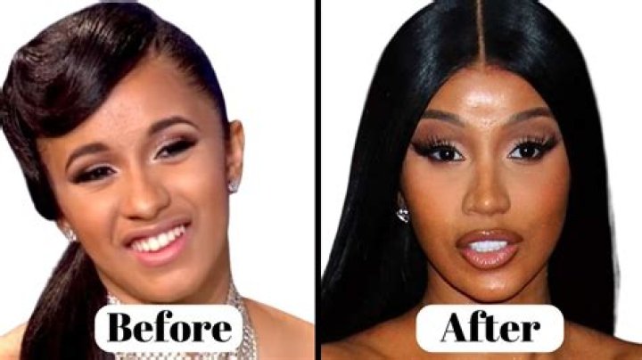 Did Yodit Yemane Have Plastic Surgery? See Her Before And After Pictures