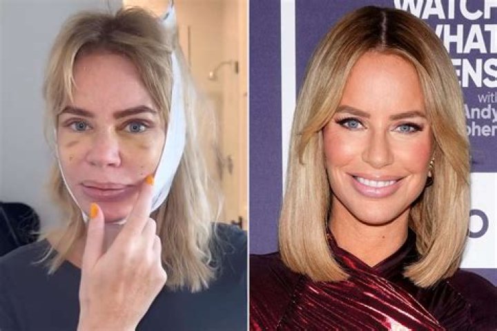 Real House Wives Of Dubai: Caroline Stanbury Before And After Plastic Surgery Pictures