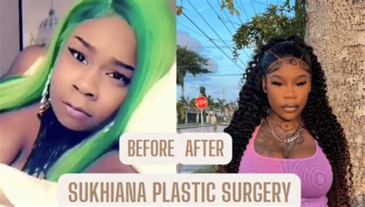 Sukihana Before Plastic Surgery: How Was She Prior to Breast Augmentation, Brazilian Butt Lift & Veneers?