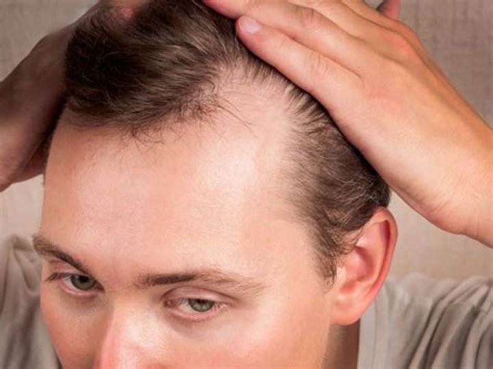 What Happened To Wayne Brady Hair? Hairline And Baldness Explored